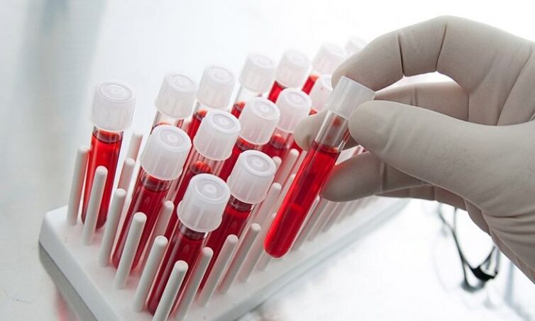 αίμα σε δοκιμαστικούς σωλήνες για ανάλυση σκύλου με προστατίτιδα